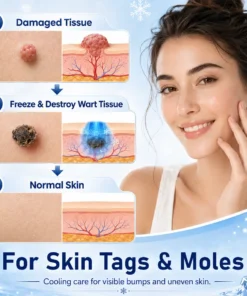 Ceoerty® CryoClear Pro Bump Renewal Spray