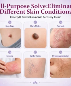 Ceoerty® DermaBloom Skin Recovery Cream