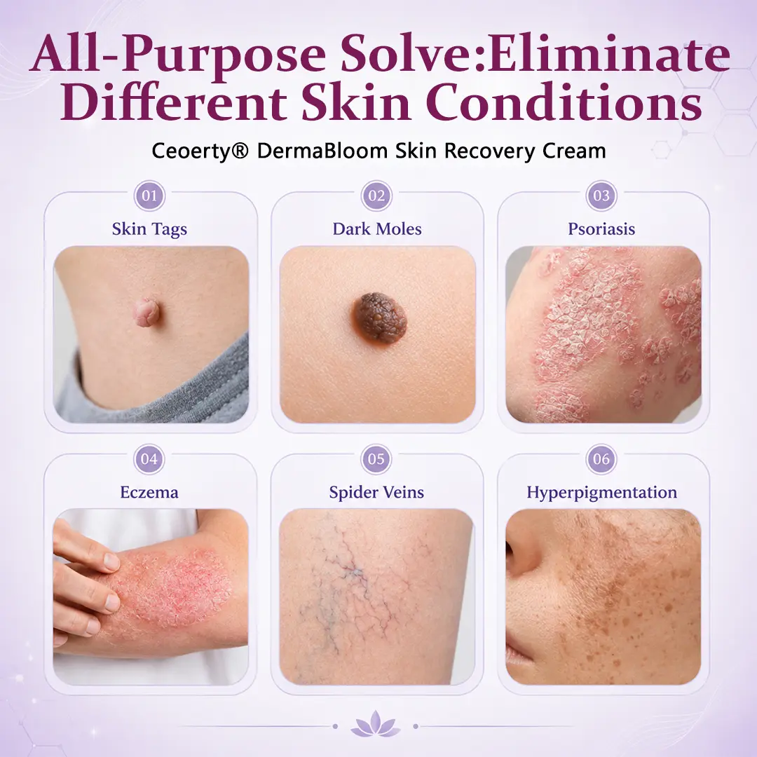 Ceoerty® DermaBloom Skin Recovery Cream