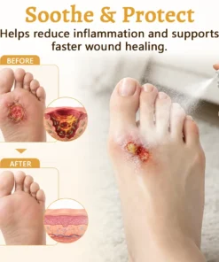 Ceoerty® DermaVeil Foot Defense Mist