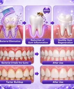 Ceoerty® Gingivitis Periodontal Treatment Toothpaste