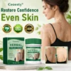 Ceoerty® Herbal Vitiligo Cream