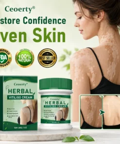 Ceoerty® Herbal Vitiligo Cream