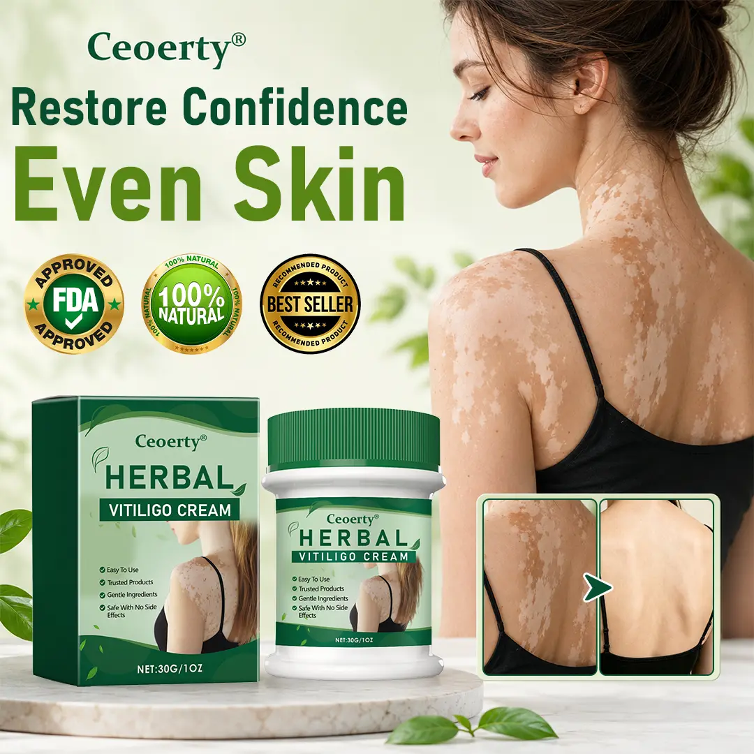 Ceoerty® Herbal Vitiligo Cream