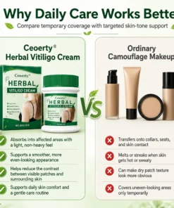 Ceoerty® Herbal Vitiligo Cream