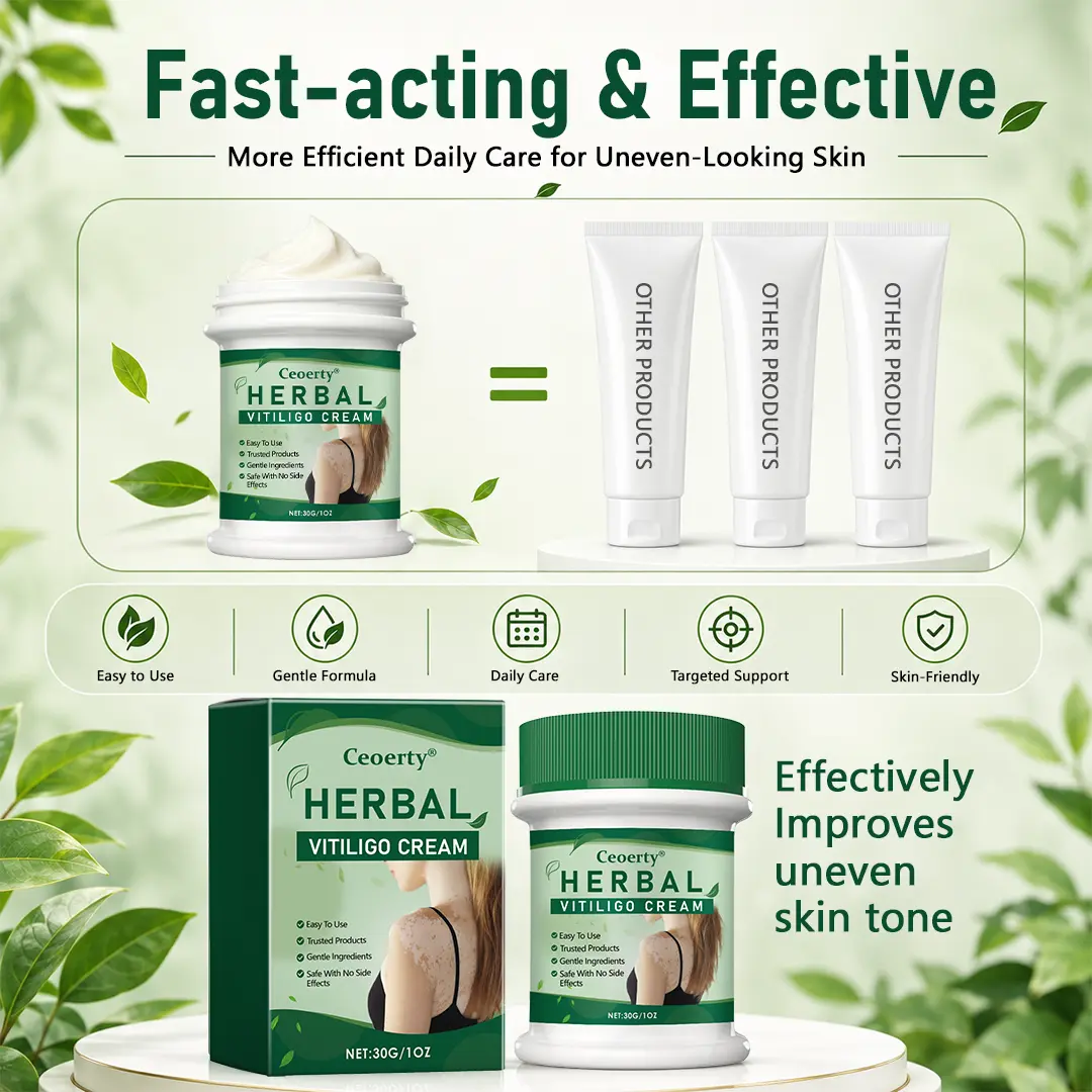 Ceoerty® Herbal Vitiligo Cream