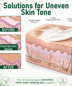 Ceoerty® Herbal Vitiligo Cream