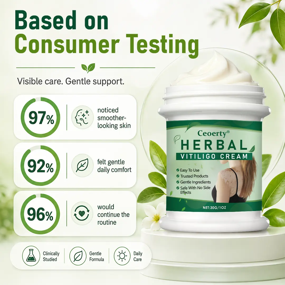 Ceoerty® Herbal Vitiligo Cream