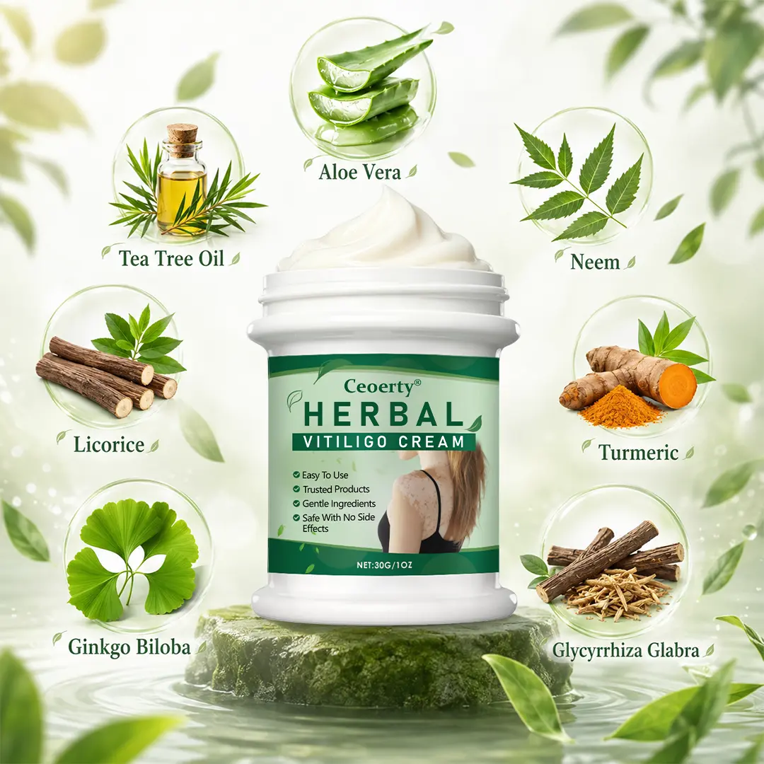 Ceoerty® Herbal Vitiligo Cream