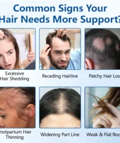 Ceoerty® RootVive Hair Growth Serum Roll-On