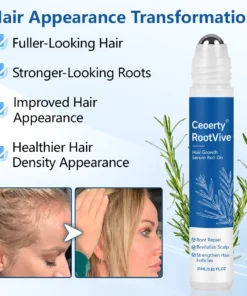 Ceoerty® RootVive Hair Growth Serum Roll-On