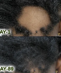 Ceoerty® Batana Natural Hair Growth Oil
