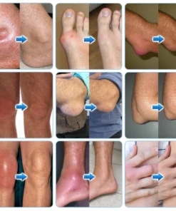 Ceoerty® JointVive Advanced Recovery Roll-On