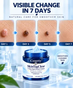 Ceoerty® SkinTagClear 7-Day Spot Eraser Cream