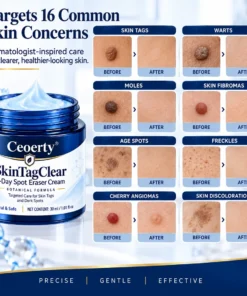 Ceoerty® SkinTagClear 7-Day Spot Eraser Cream