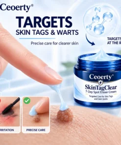 Ceoerty® SkinTagClear 7-Day Spot Eraser Cream