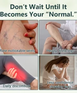 Ceoerty®VenoVelle Advanced Vein Care Oil
